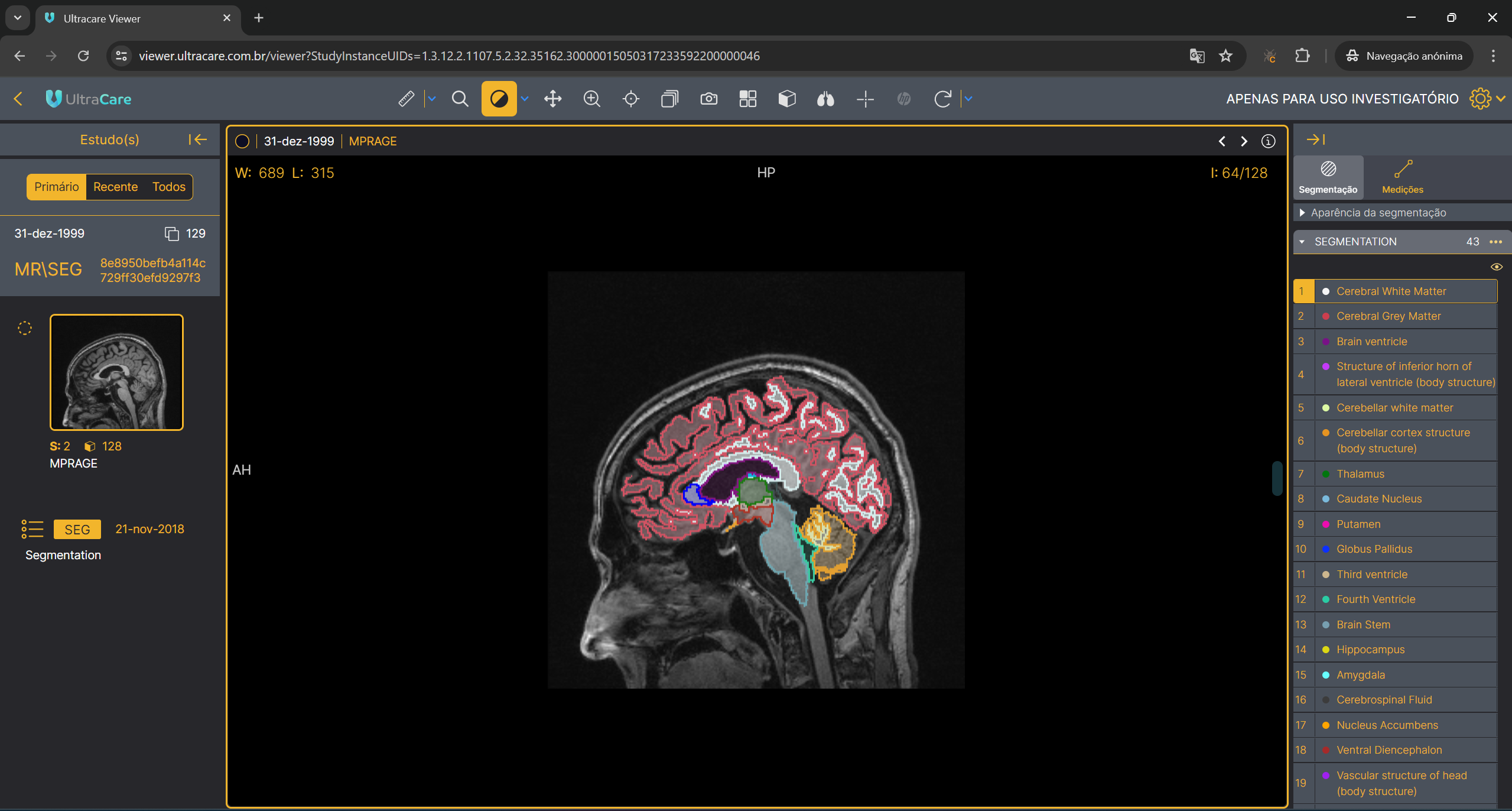 ultra-segmentacao-01